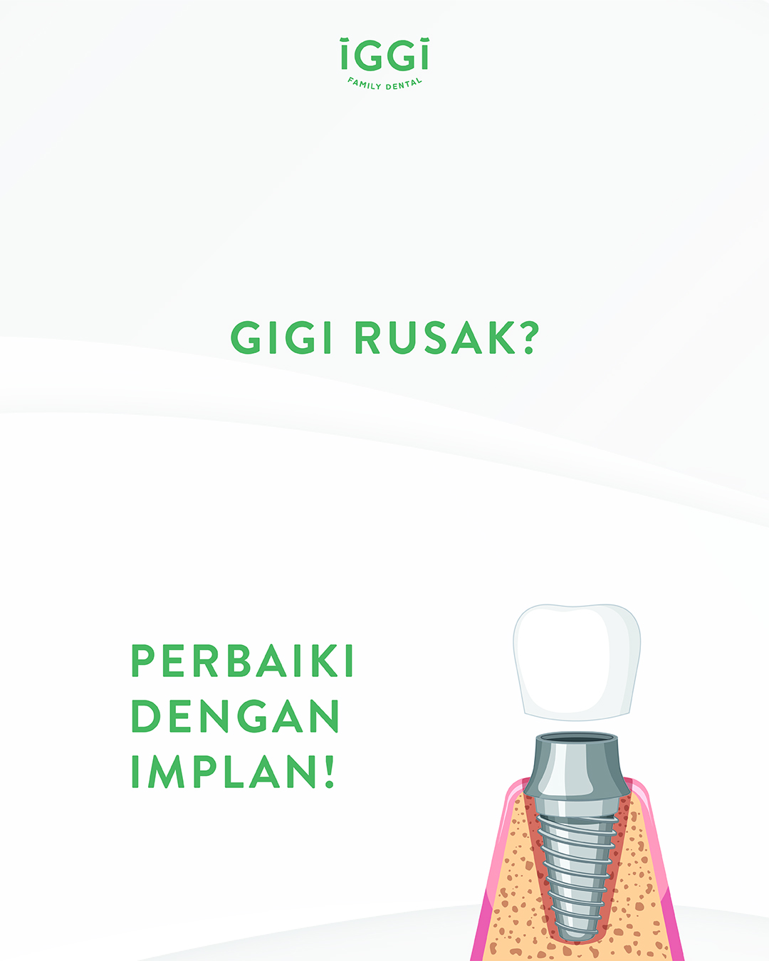 IGGI Dental Implan Gigi slide 1